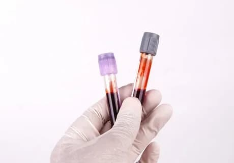 How to Prepare Lab Samples for Fast Pickup